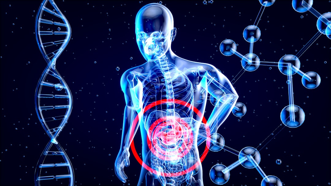 Hyperthermic Intraperitoneal Chemotherapy in Ovarian Cancer.