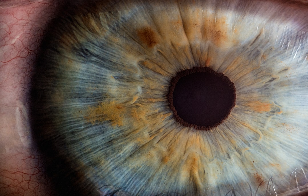 Panretinal Photocoagulation vs Intravitreous Ranibizumab for Proliferative Diabetic Retinopathy: A Randomized Clinical Trial.